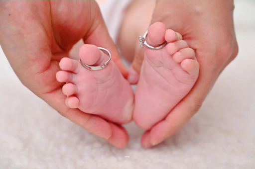 琼中孕妇怎样预防妊娠纹